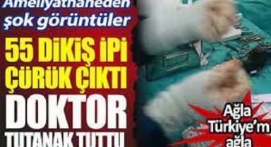 55 dikiş ipi çürük çıktı doktor tutanak tuttu. Ameliyathaneden şok görüntüler. Ağla Türkiye’m ağla