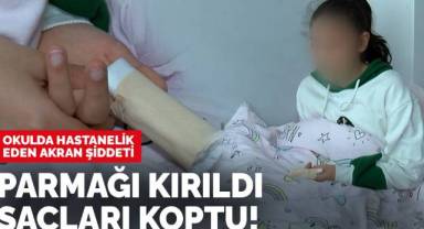 Akran şiddetine maruz kalan çocuğun parmağı kırıldı, saçları...