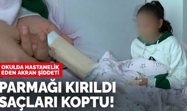 Akran şiddetine maruz kalan çocuğun parmağı kırıldı, saçları...