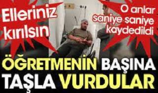 Yazıklar olsun. Veliler okulda öğretmenin başına taşla vurdular