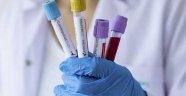 İl sağlık müdürlüklerine 'herkese test yapmayın' talimatı